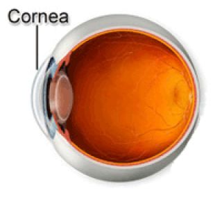 Some rust has gotten caught in your eye. On looking closely, you can see a tiny spot on the clear part of the eye (the cornea) that covers the pupil and iris. What should you do?