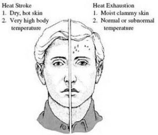 Which condition causes a breakdown of the sweating mechanism of the body?
