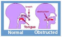 When preparing to clear the airway of a victim, of this list, which should you do first?